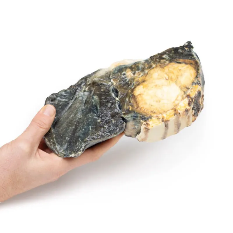 3D Printed Metastatic Tumour in Lung from Primary Testicular Cancer