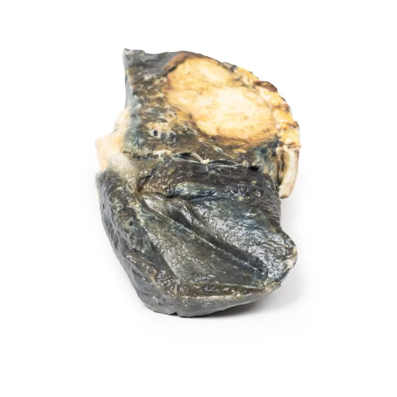 3D Printed Metastatic Tumour in Lung from Primary Testicular Cancer