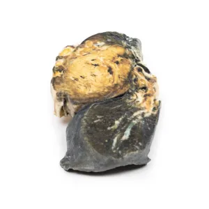 3D Printed Metastatic Tumour in Lung from Primary Testicular Cancer