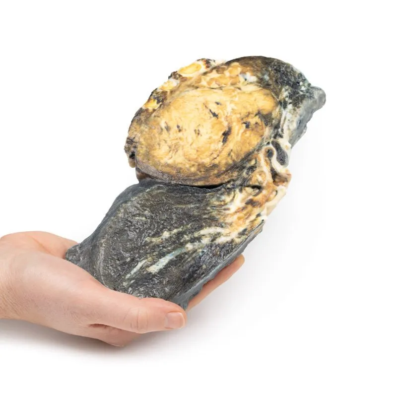3D Printed Metastatic Tumour in Lung from Primary Testicular Cancer